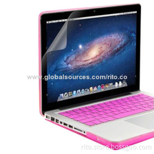 Rose Color Skin/Cover for Macbook Pro 13" Retina